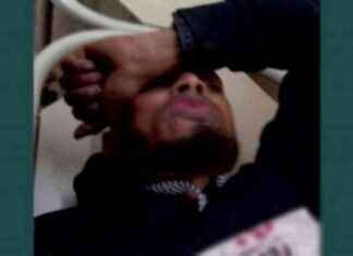 Explosion Victim in Jessore: Seeking Justice and Support explosion-victim-in-jessore-seeking-justice-and-support