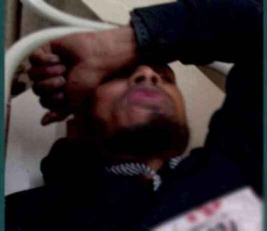 Explosion Victim in Jessore: Seeking Justice and Support explosion-victim-in-jessore-seeking-justice-and-support